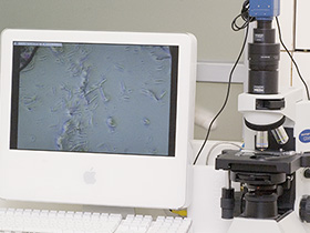 顕微鏡検査の写真